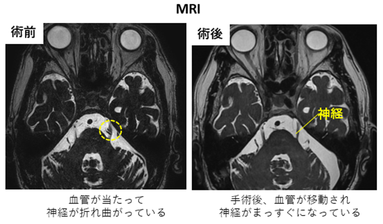 MRI