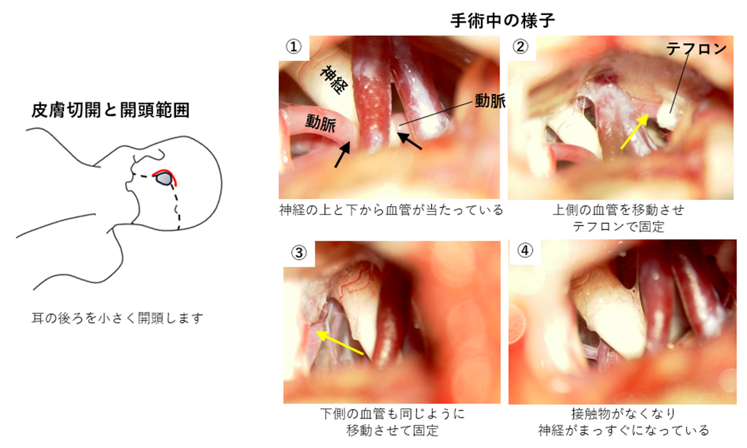 手術中の様子