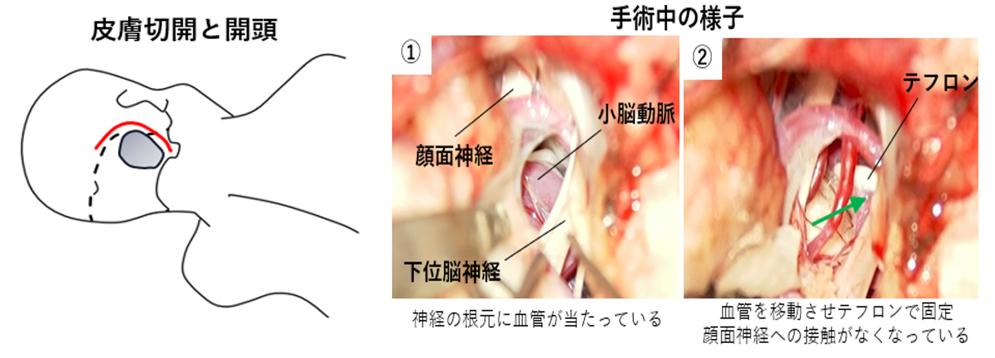手術中の様子