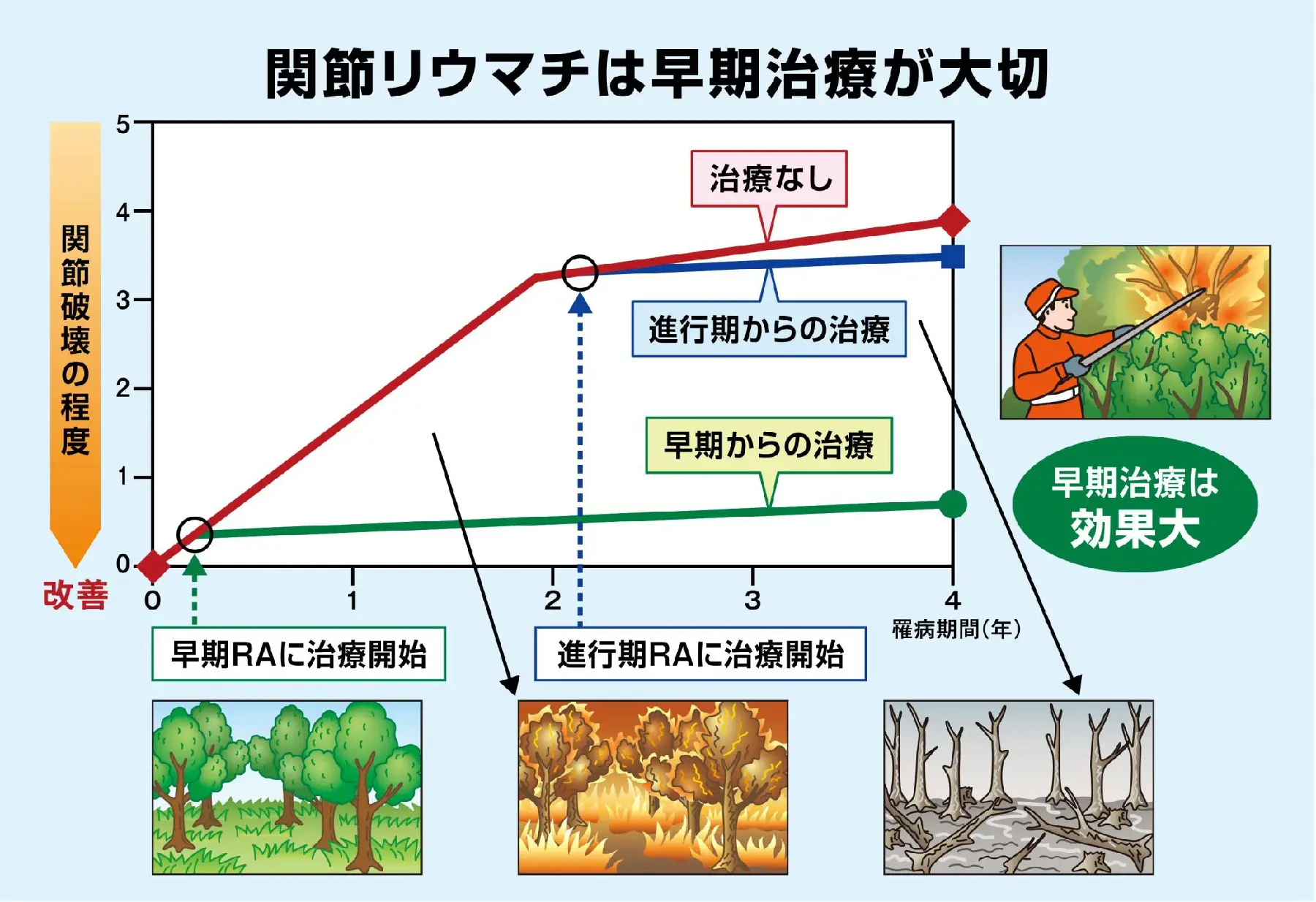 関節リウマチは早期治療が大切