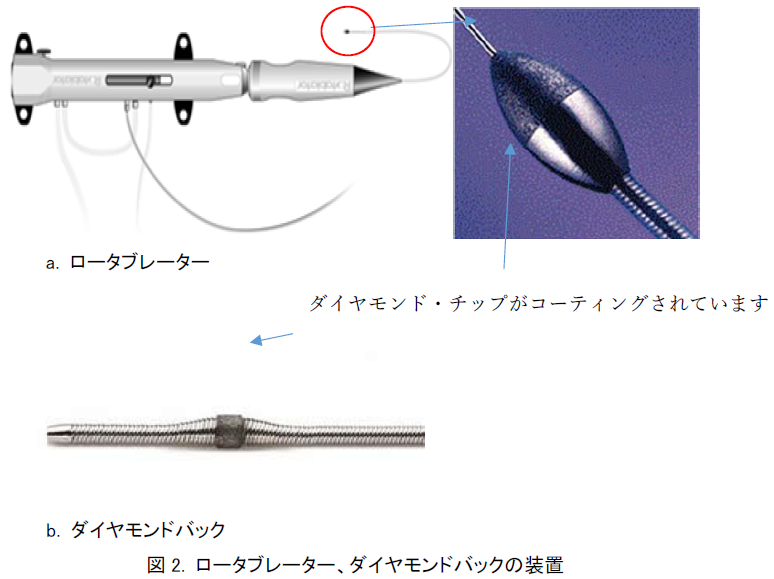 ロータブレーター、ダイヤモンドバックの装置