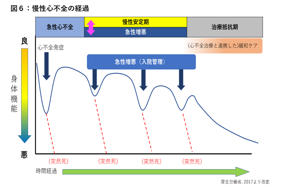 慢性心不全の経過