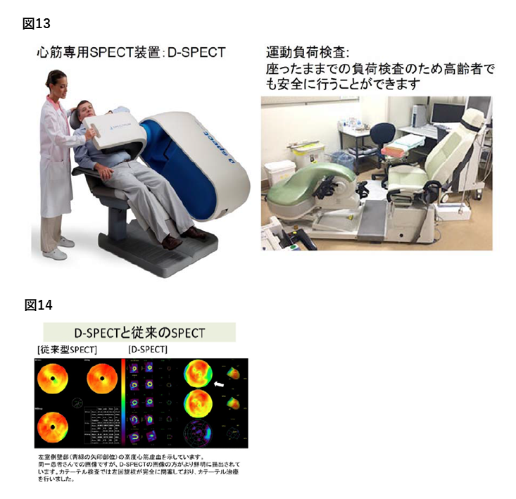 心臓核医学検査