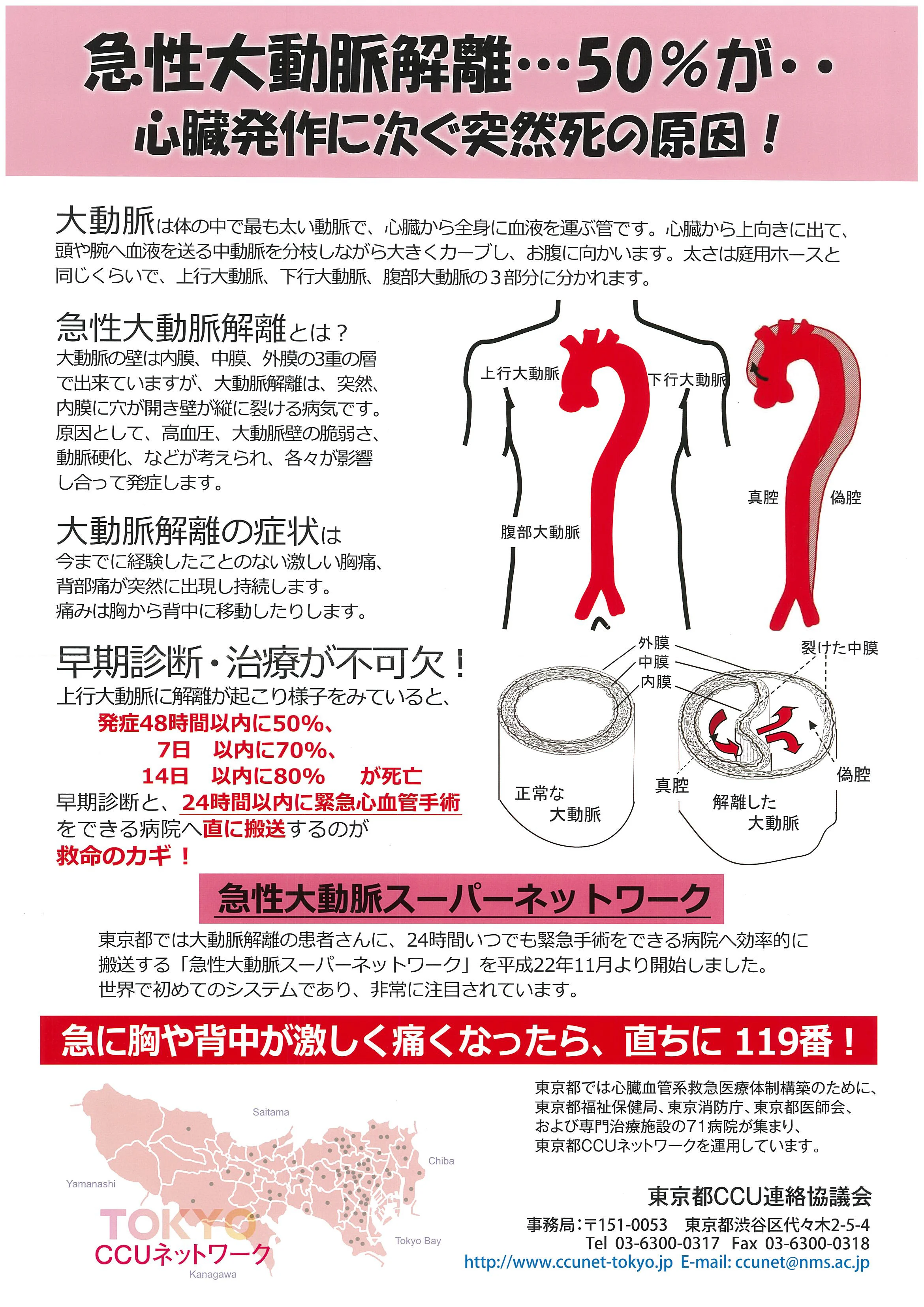 急性大動脈解離ポスター