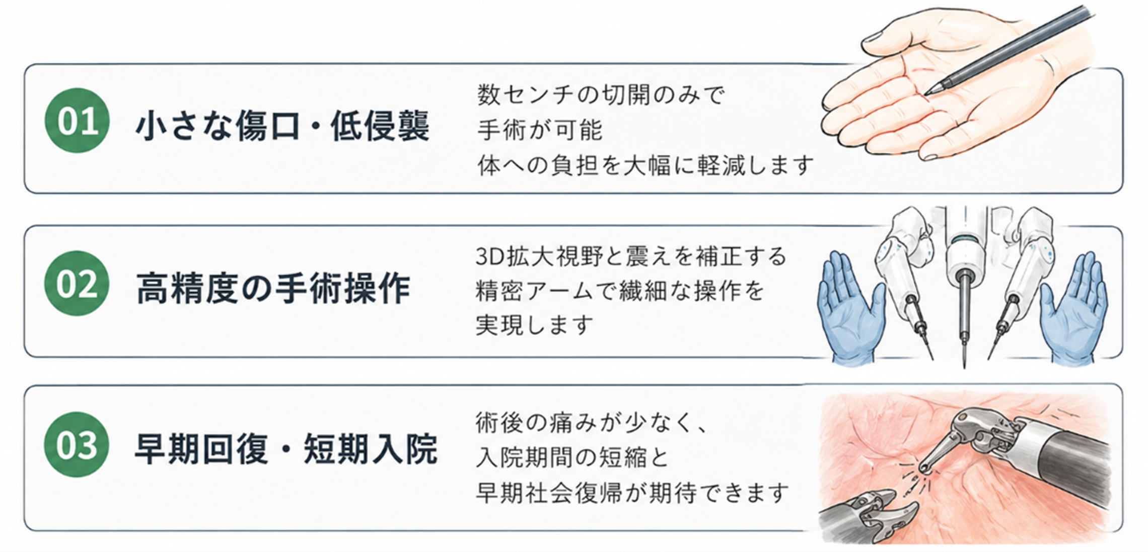 ダビンチ手術のメリットv2