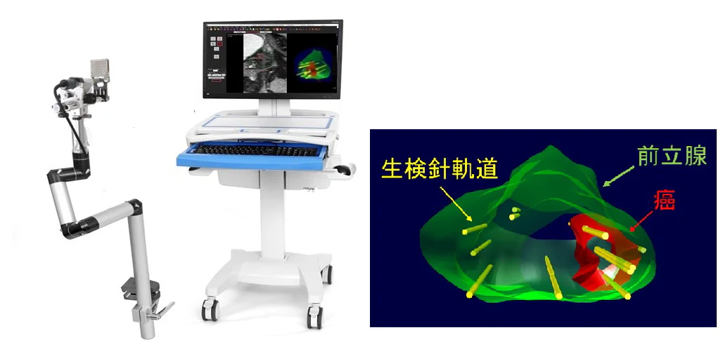 リアルタイム超音波画像下前立腺生検機器