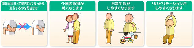 ボツリヌス療法のご説明