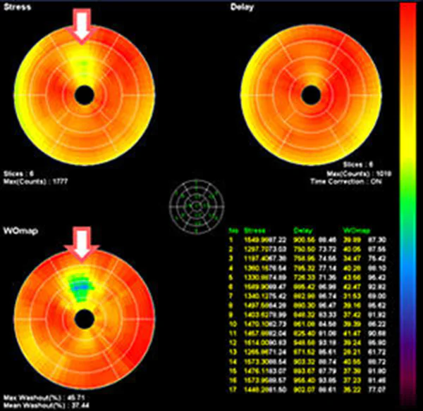 Bulls eye map
