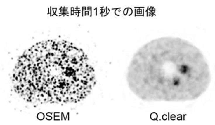 図PET4_MIにて1秒で収集したファントーム画像