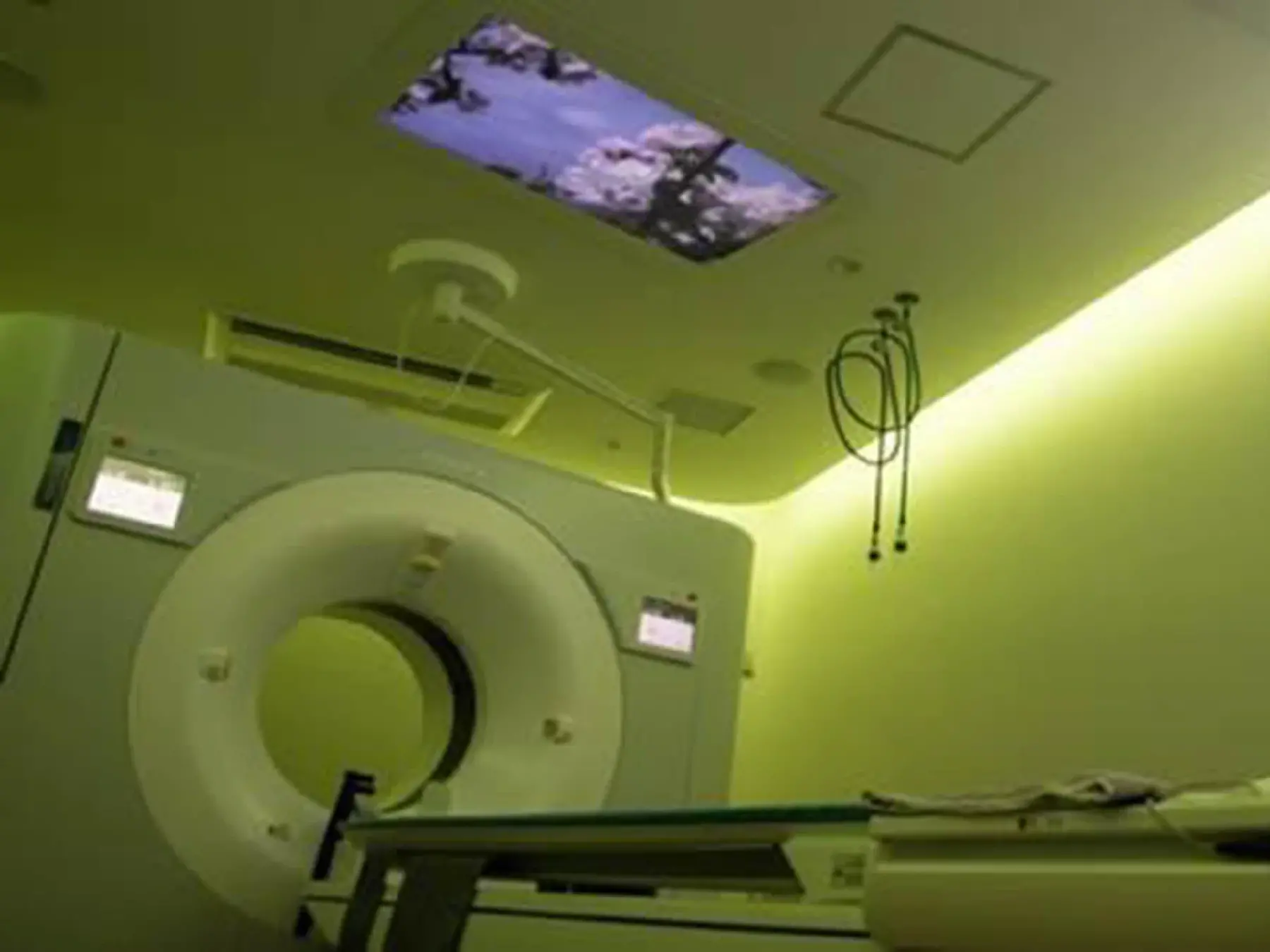 IQon Spectral CT(Philips Japan)