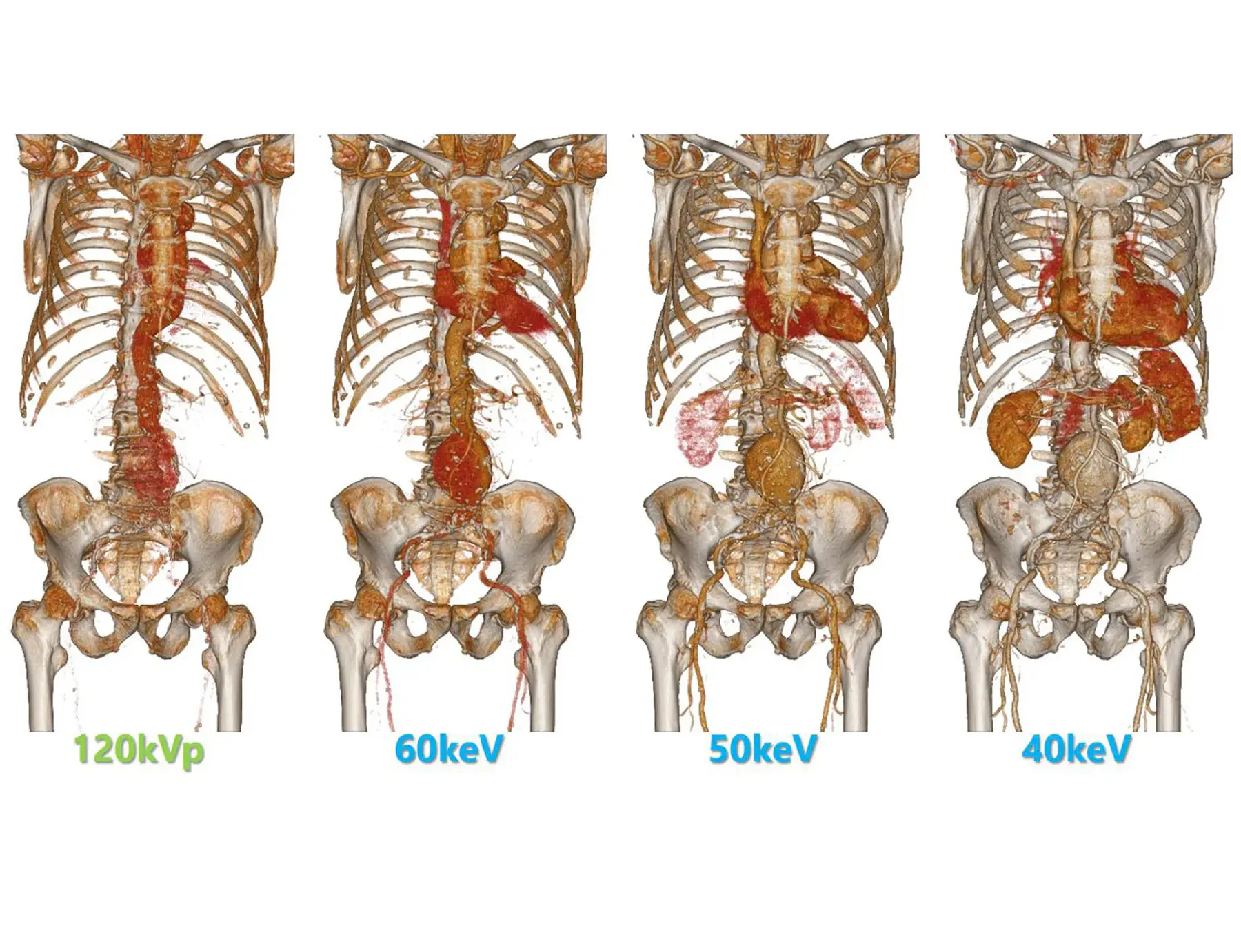 IQon Spectral CT(Philips Japan)
