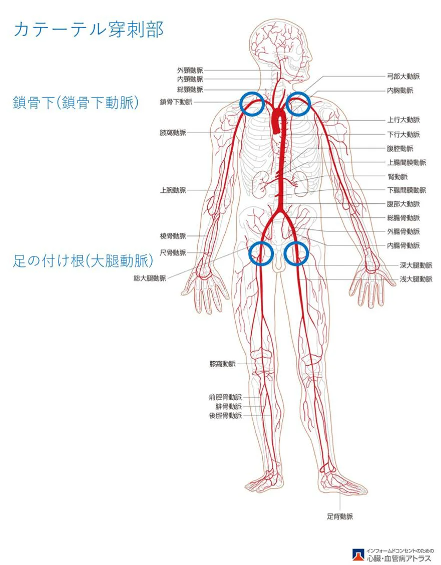 インペラの挿入部分