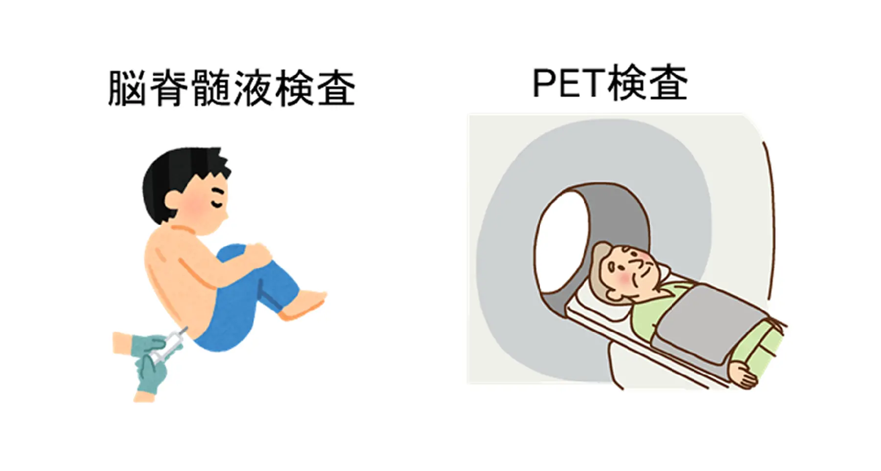 軽度認知障害（MCI）