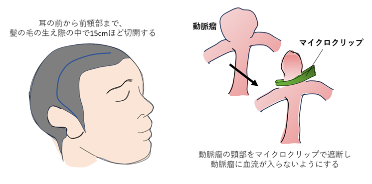 開頭クリッピング術01