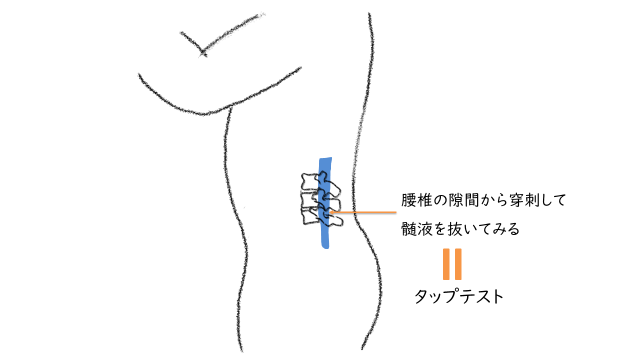 タップテスト05