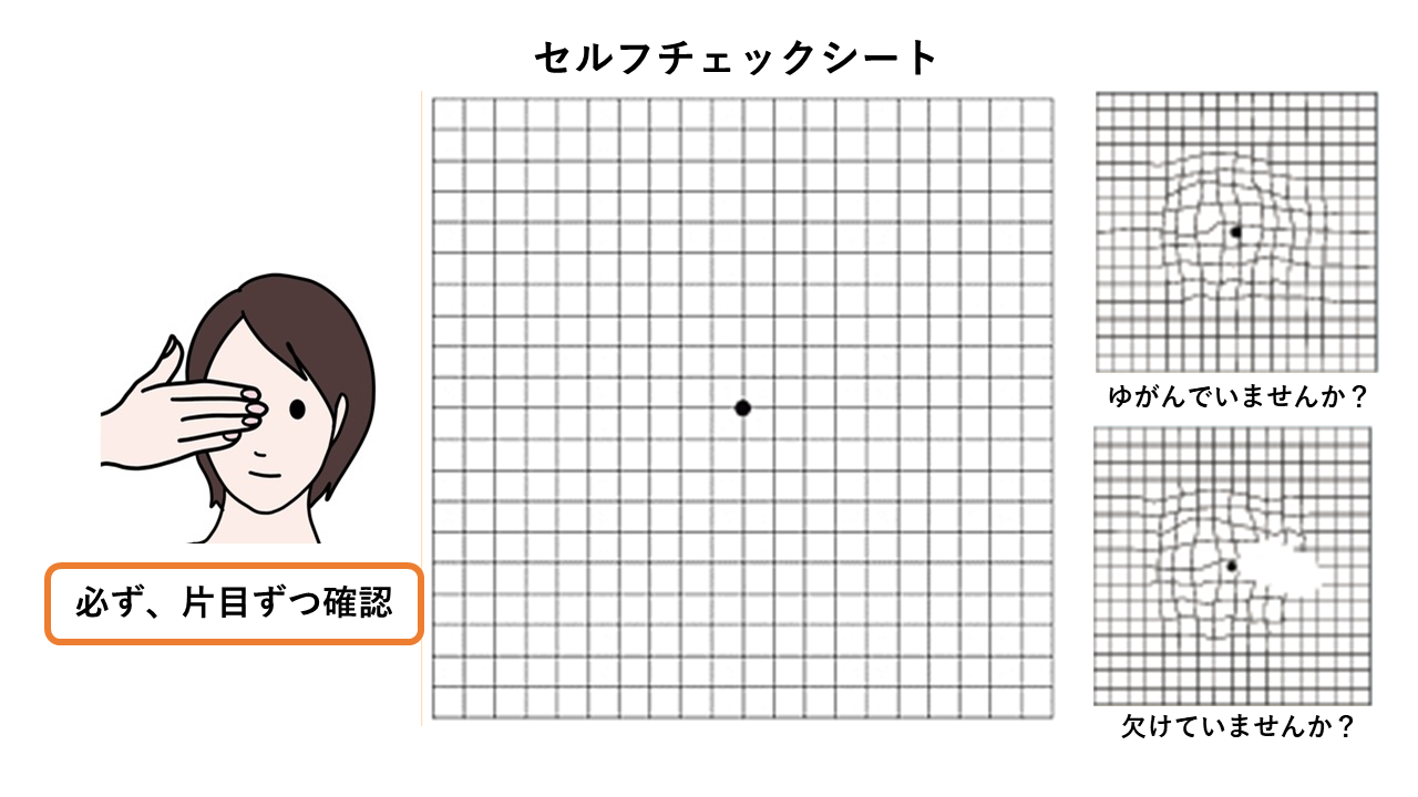 セルフチェックシート