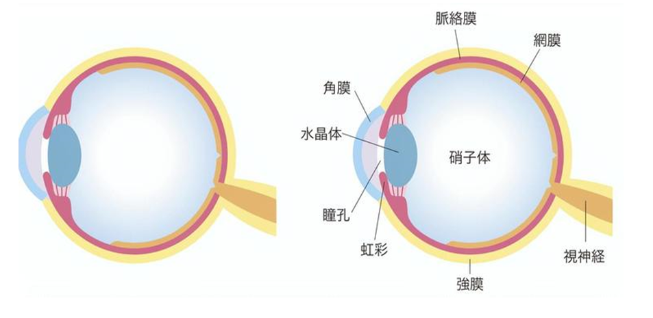 白内障01
