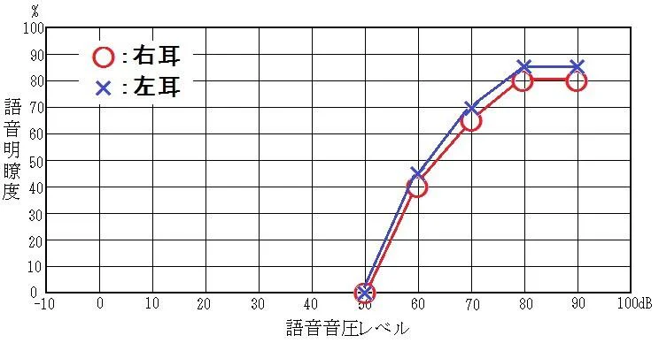 語音明瞭度検査02