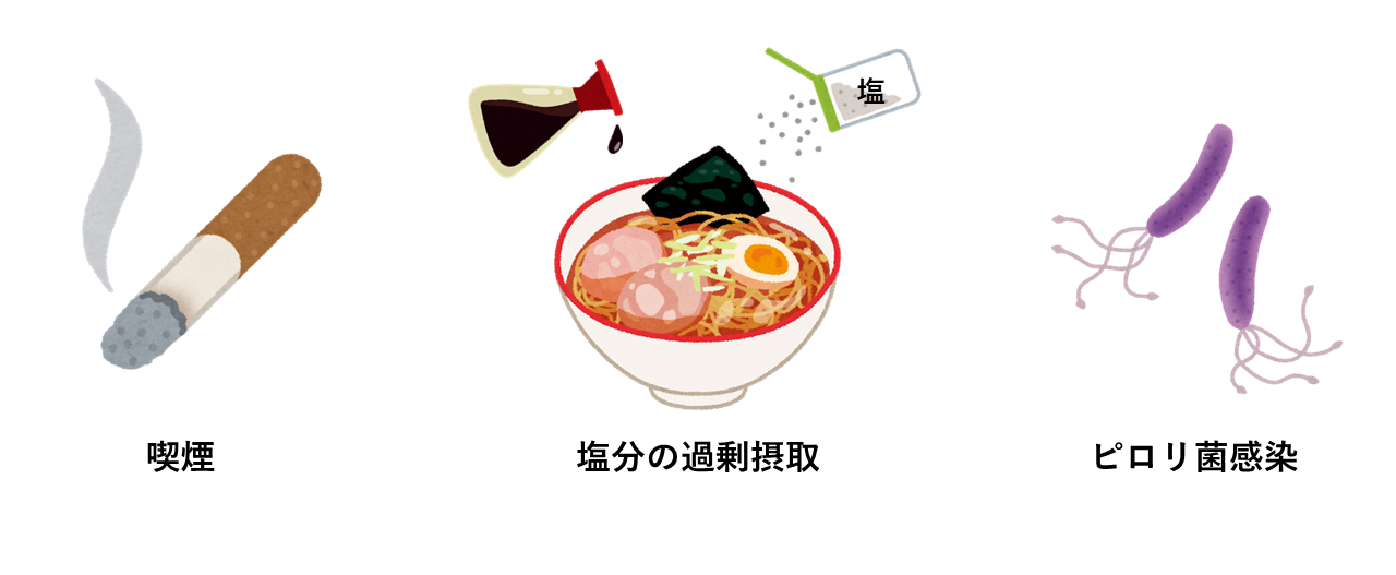 胃がん01