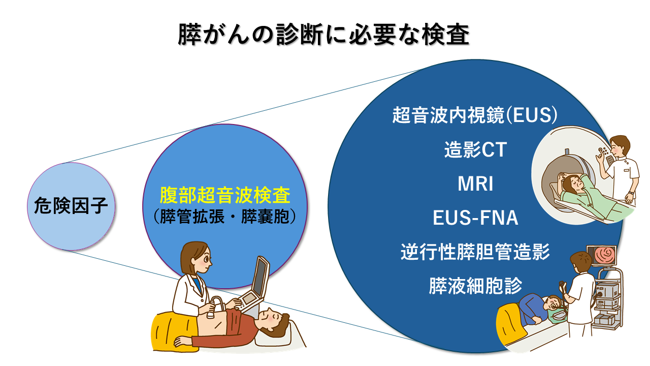 膵がんの診断に必要な検査