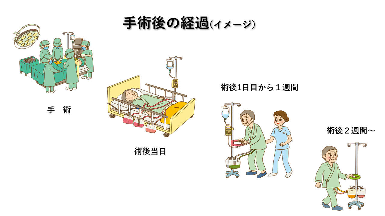 手術後の経過