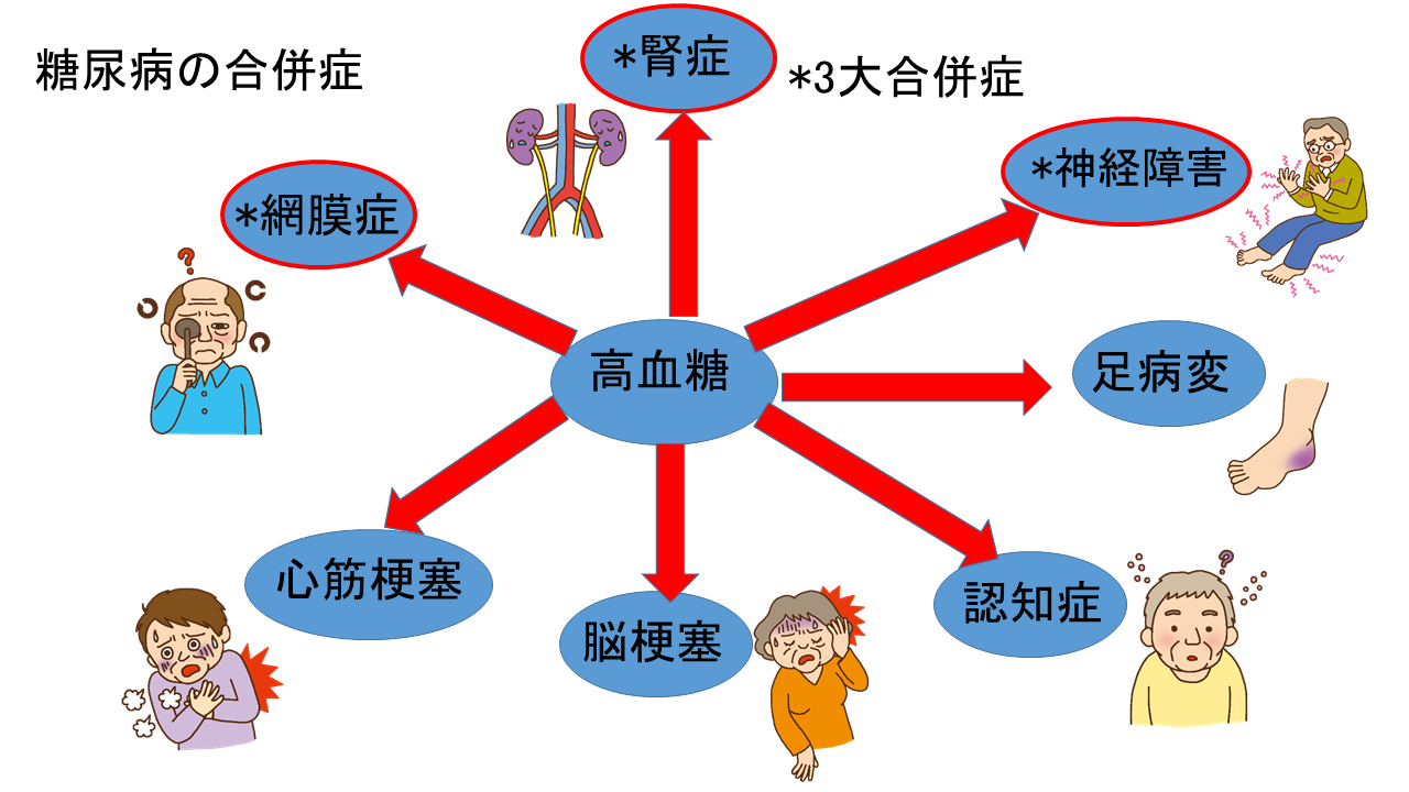 糖尿病の合併症