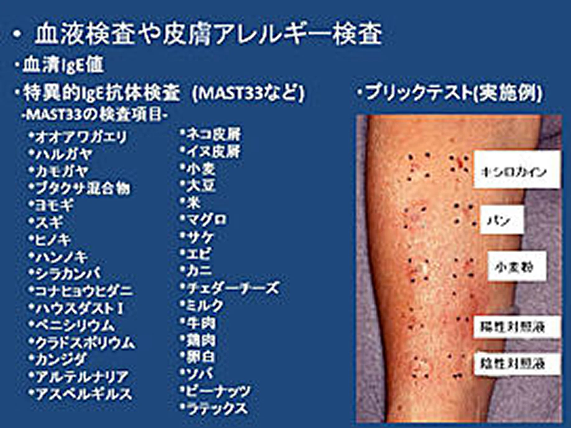 血液検査や皮膚アレルギー検査