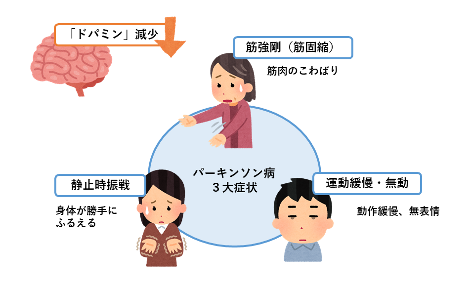 パーキンソン病3大症状