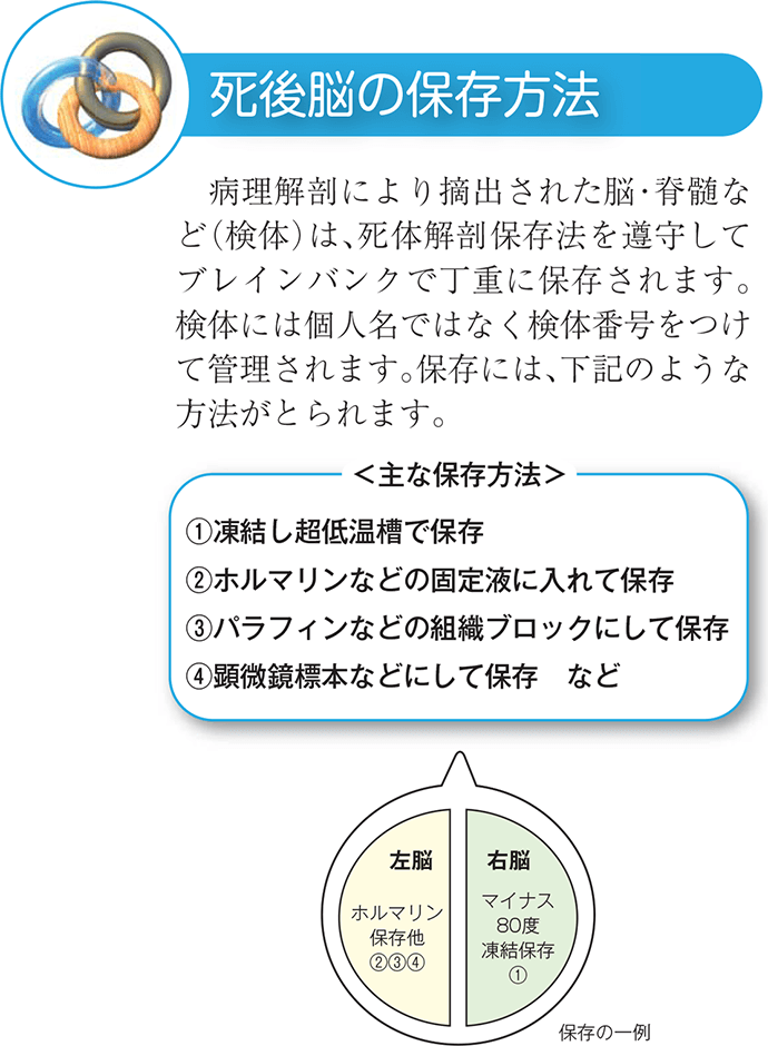死後脳の保存方法