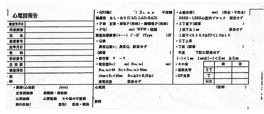 心電図所見