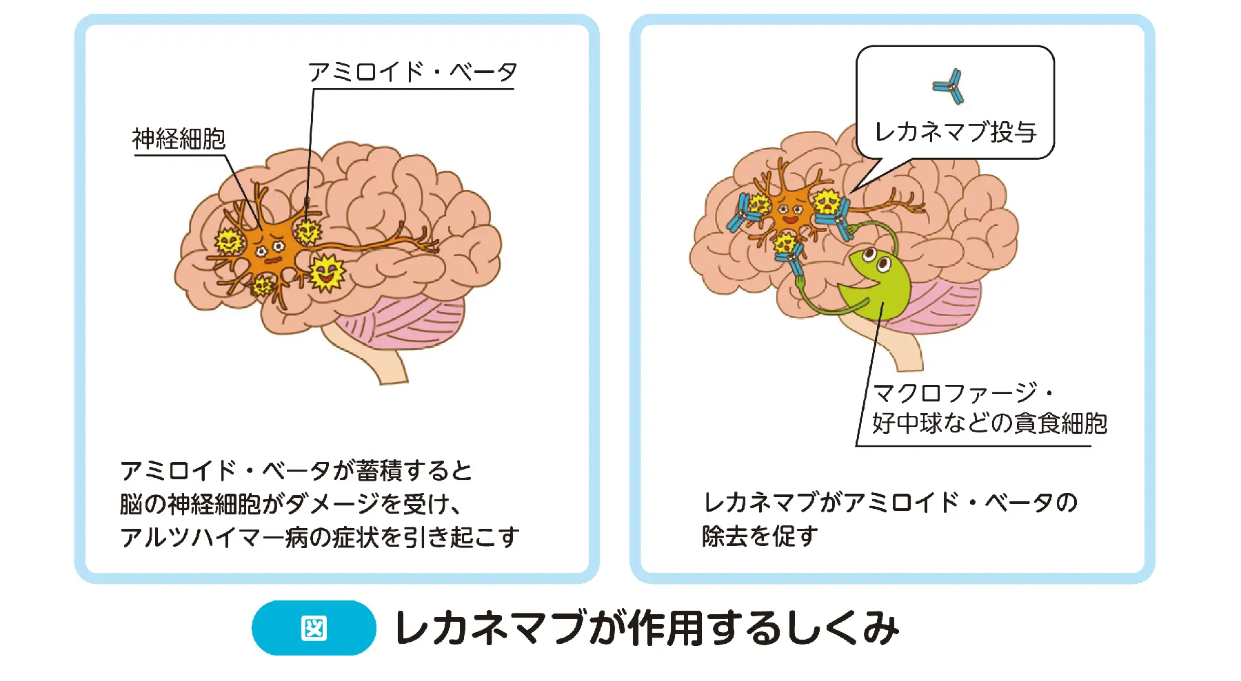 レカネマブ