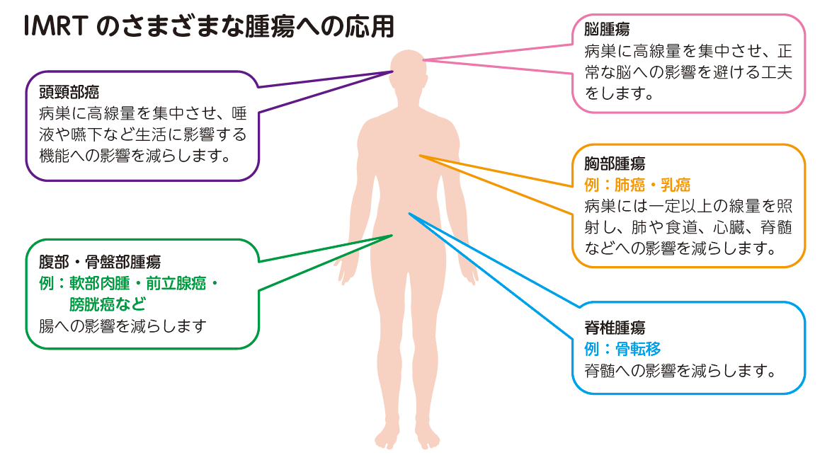 放射線治療科02