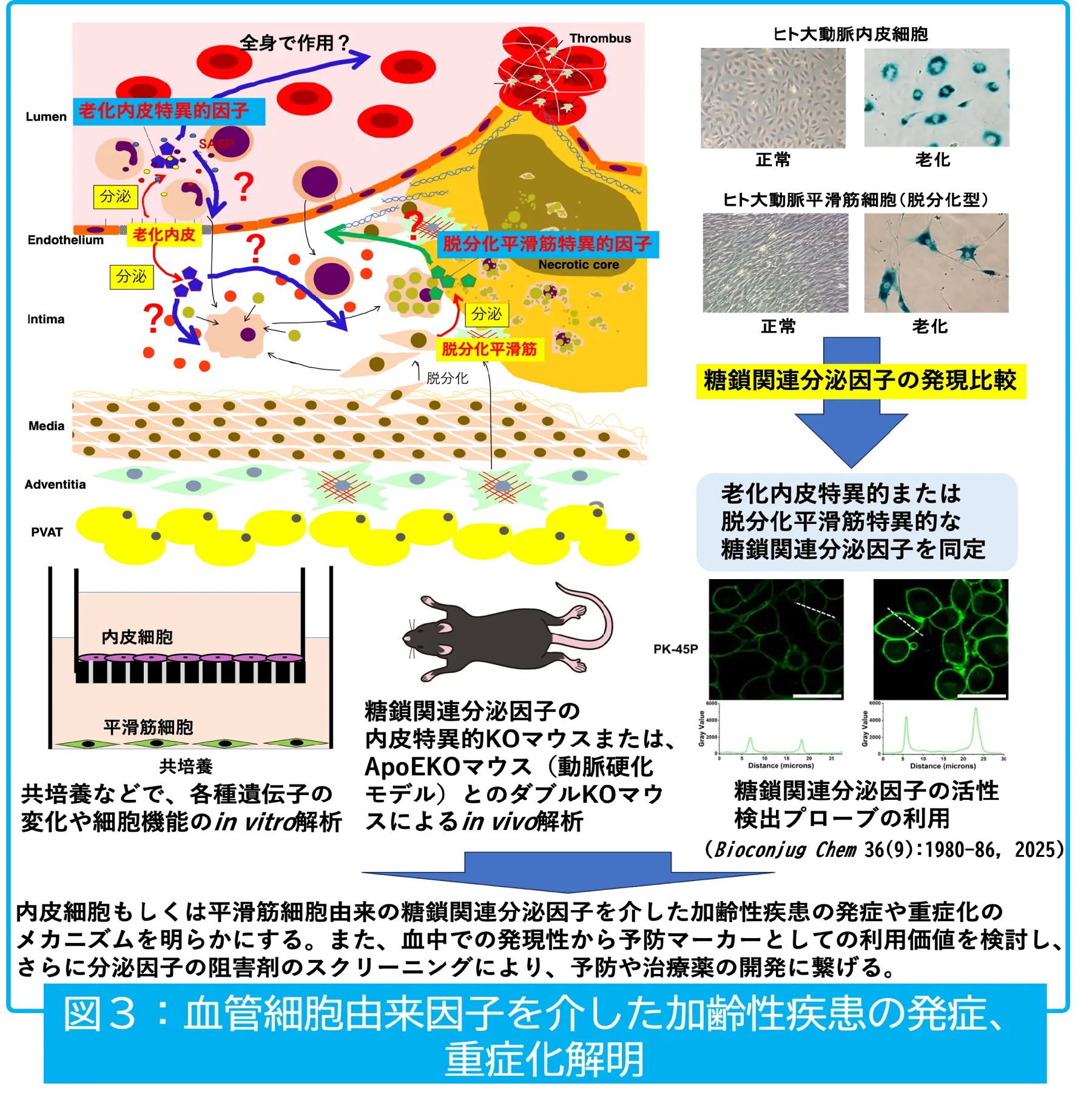 血管細胞由来因子を介した加齢性疾患の発症、重症化解明