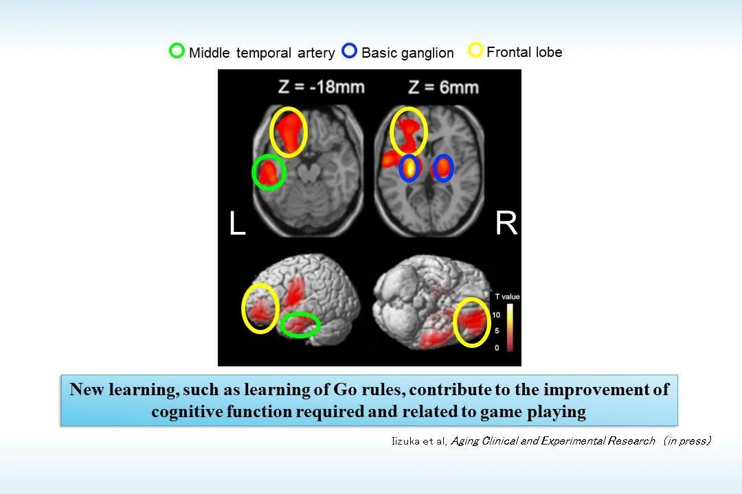 New learning such as learning of Go rules contribute to the improvement of cognitive function required and related to game playing