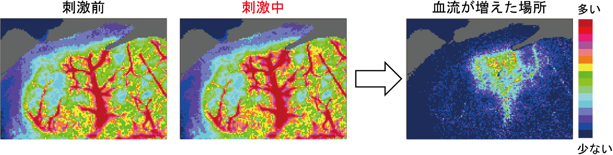 麻酔したネズミの脳血流画像