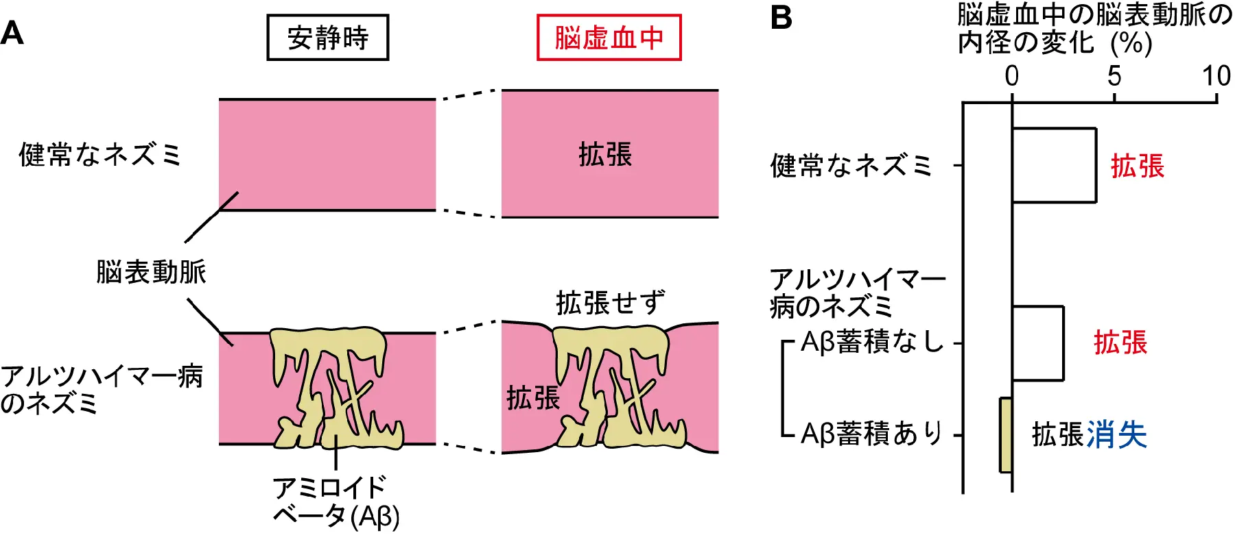 脳血管および蓄積したアミロイドベータの模式図（A）と脳虚血中の脳表動脈の内径の変化を示すグラフ（B）