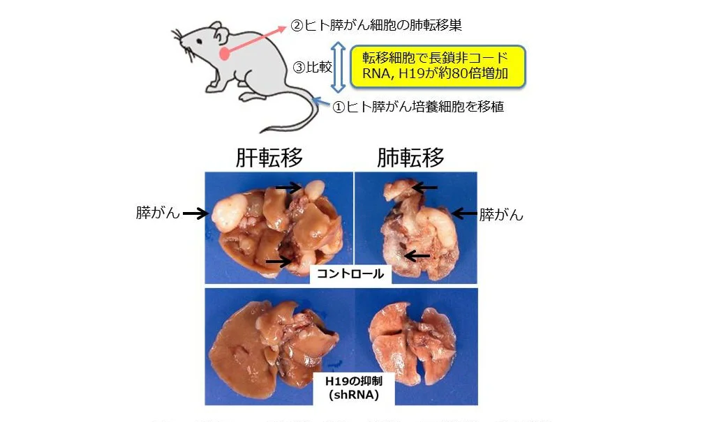 長鎖非コードRNA、H9の抑御による膵がんの転移減少