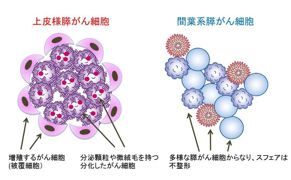 上皮様と間葉系の膵がん細胞のスフェア