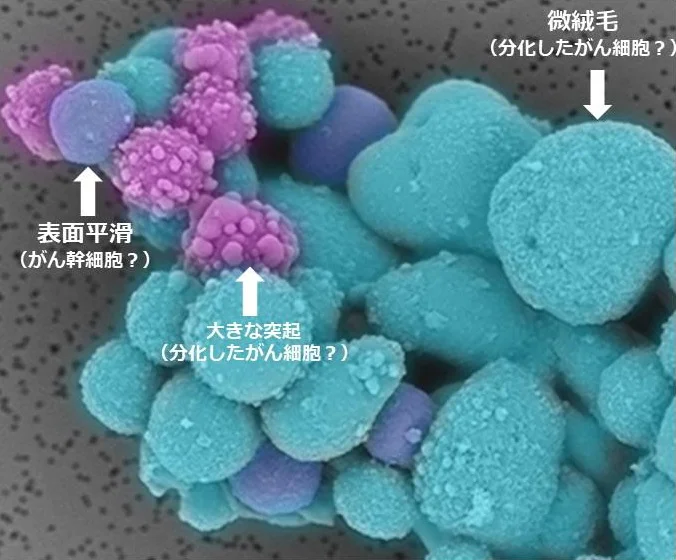 スフェアを形成する多様な膵がん細胞