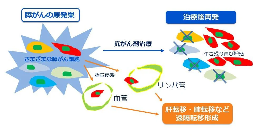 膵がん細胞の多様性と再発、転移の関係