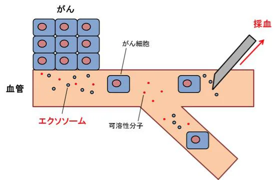 リキッドバイオプシー