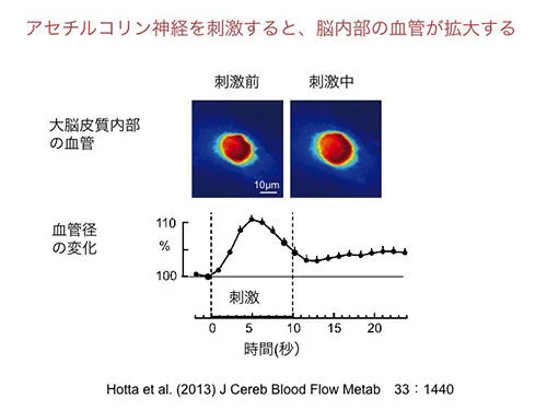 アセチルコリン神経を刺激すると、脳内部の欠陥が拡大する