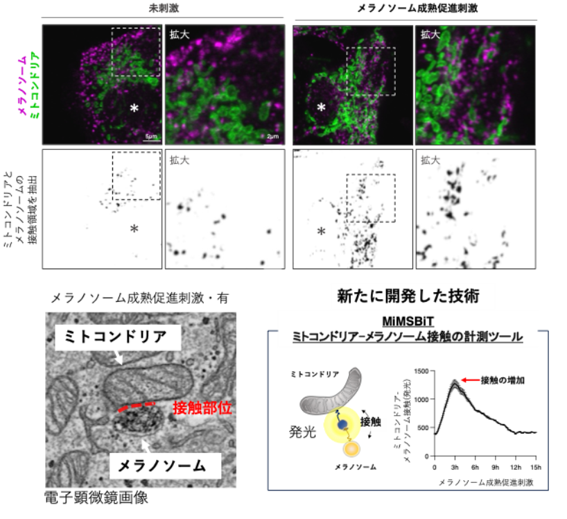 ミトコンドリア（緑）とメラノソーム（紫）が細胞内で近接している様子（上段）と、電子顕微鏡による接触部位の観察像（左下）。