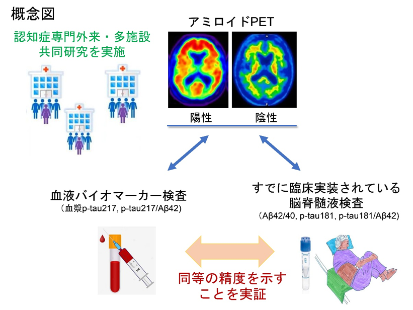 血漿p-tau217は脳アミロイド蓄積に対して脳脊髄液バイオマーカーと同等の検出精度を示す－多施設共同前向き臨床試験で実証－01