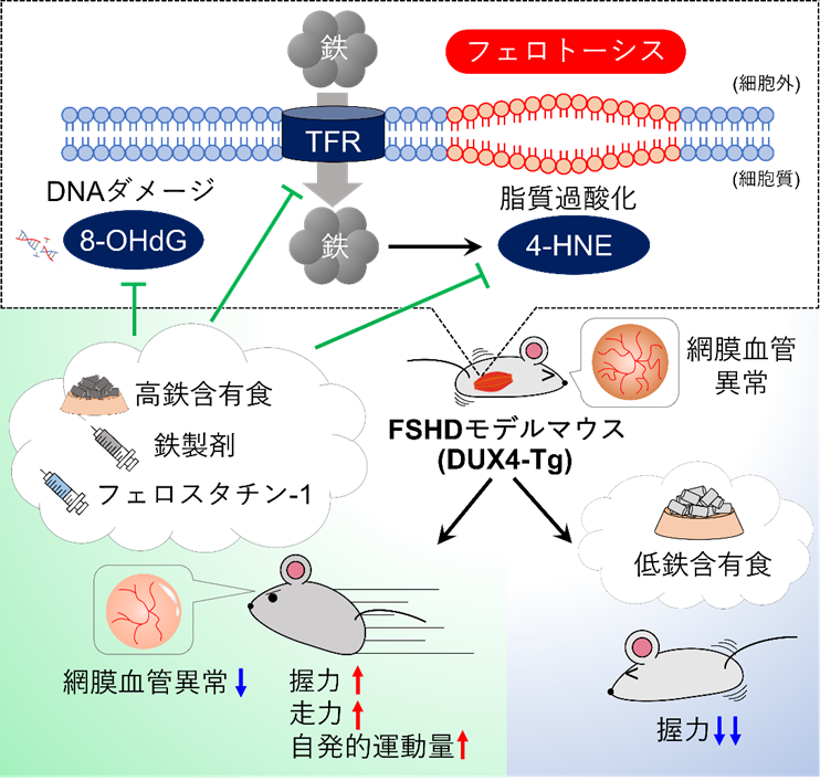 DUX4の細胞毒性に鉄代謝異常とフェロトーシス経路の関与が明らかになり、FSHDに対する新たな治療標的が見出された。