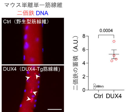 DUX4-Tgマウス筋線維における鉄蓄積